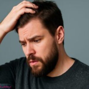 چگونه شوره سر را از بین ببریم؟ ۵ روش درمان شوره سر